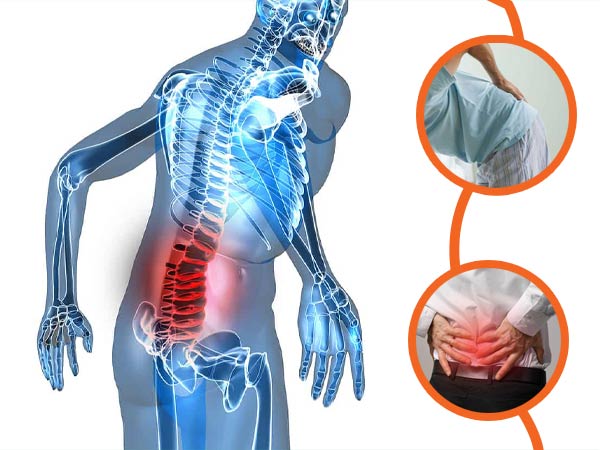 Đau Thắt Lưng: Nguyên nhân, triệu chứng, cách điều trị